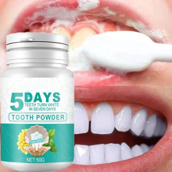 Зубная паста для отбеливания зубов, 5 дней, 50 г