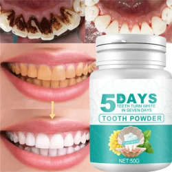 Зубная паста для отбеливания зубов, 5 дней, 50 г